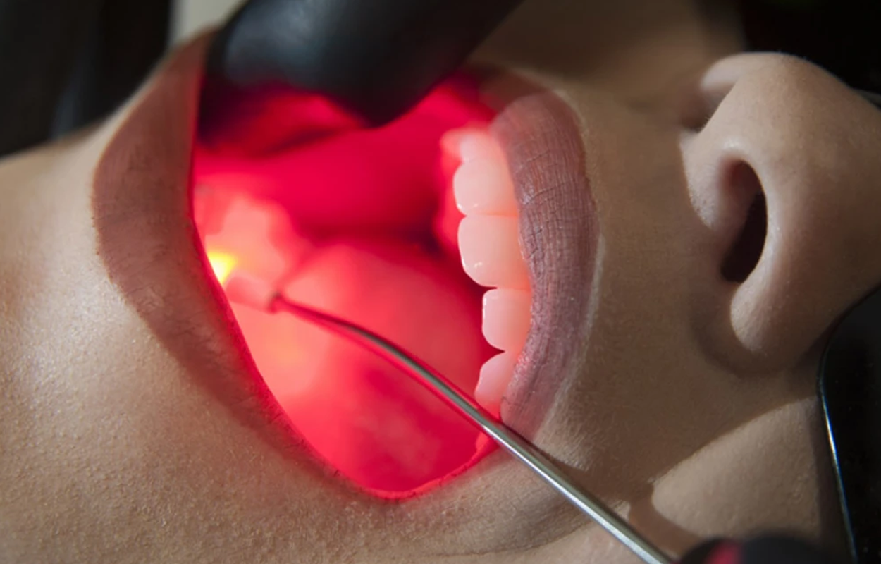 tratamento a laser em odontologia: parestesia, hipersensibilidade e cuidado oncológico